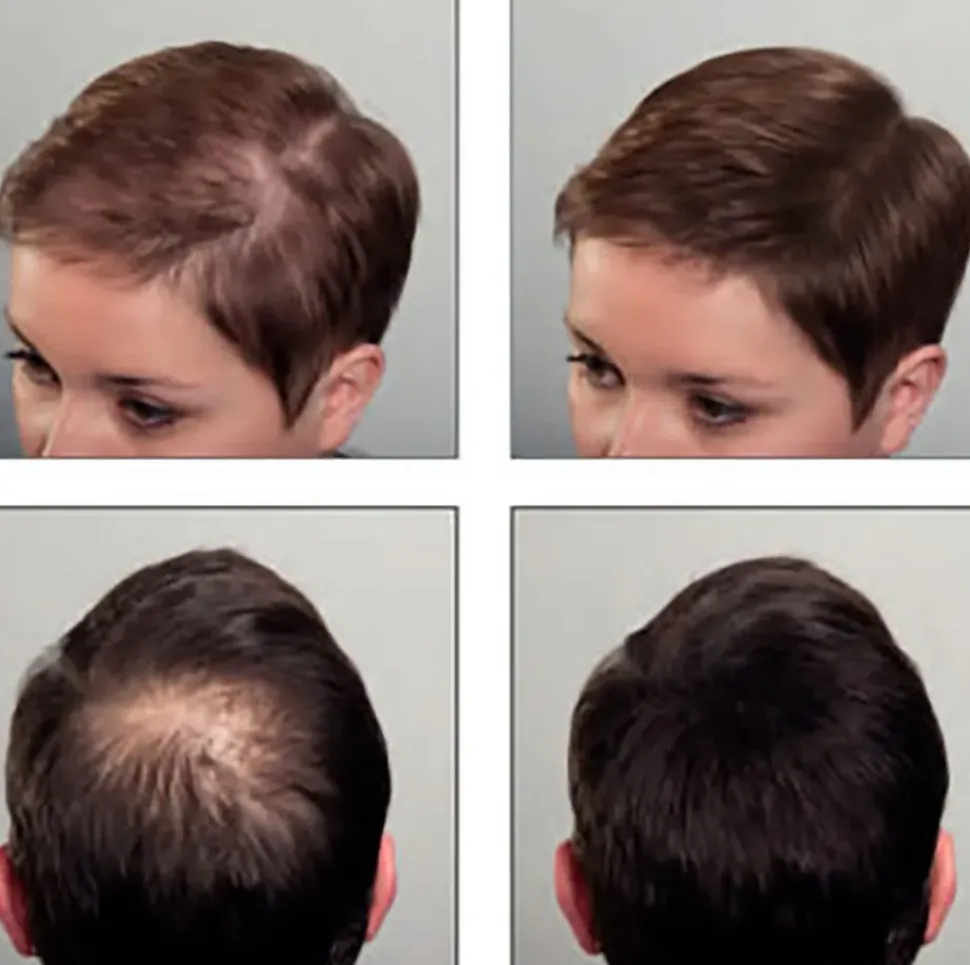 Sibel - Hair Sculptor Hair Building Fibers Dark Brown 25 g